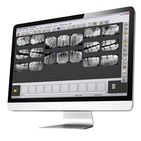 Software Gendex VixWin Platinum .